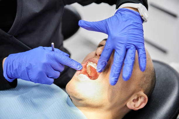 Best Emergency Dental Care for Broken or Chipped Teeth in Fanning Springs, FL