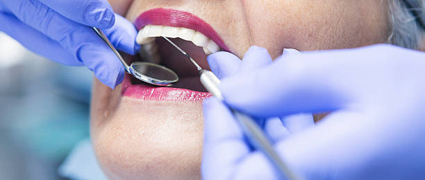 Best Emergency Tooth Extraction in Fanning Springs, FL